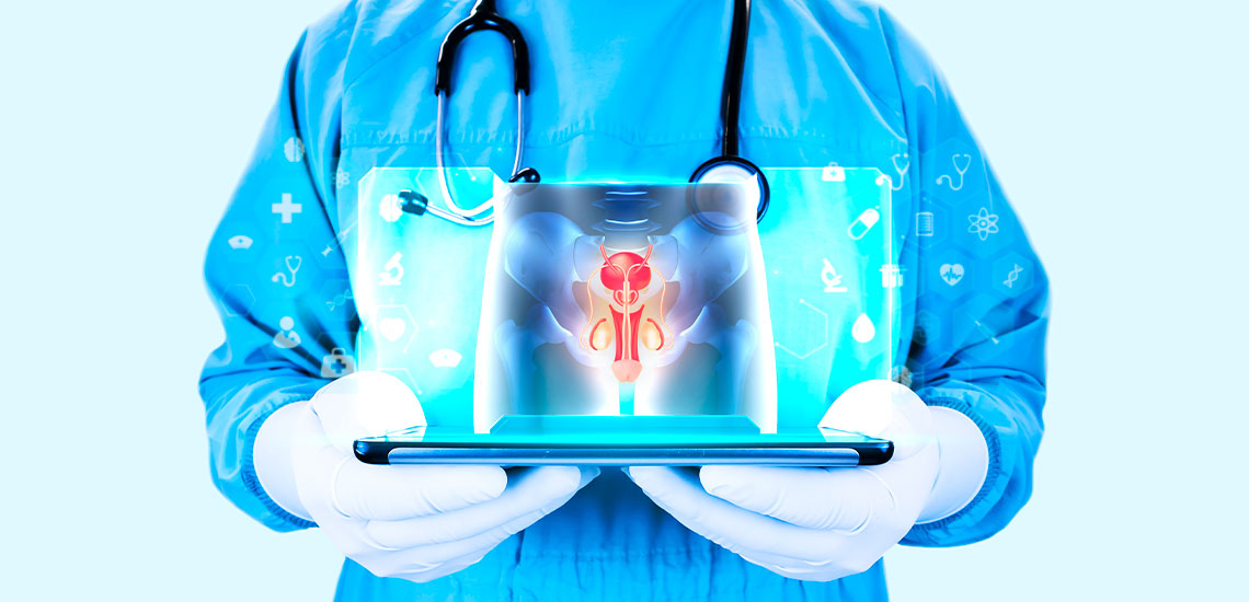 Tratamiento de hiperplasia prostática benigna sin cirugía: opciones naturales y médicas